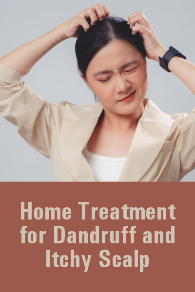 Home Treatment for Dandruff and Itchy Scalp