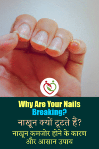 Why Are Your Nails Breaking?
